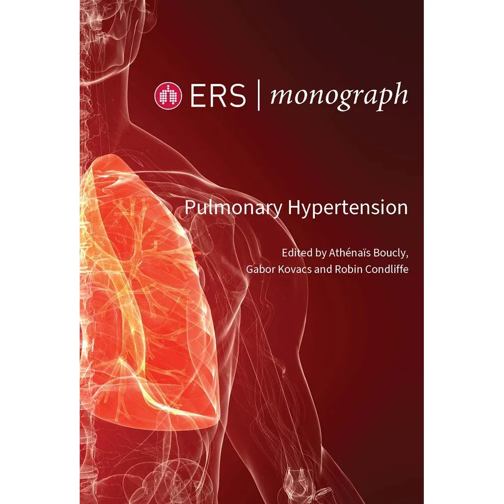 Pulmonary Hypertension (ERS Monograph 109) (EPUB)